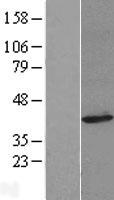 CYRIA Human Over-expression Lysate