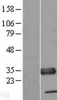 TXNDC (TMX1) Human Over-expression Lysate