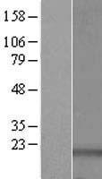 PDRG1 Human Over-expression Lysate