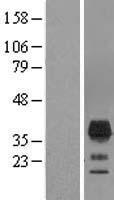 TMEM163 Human Over-expression Lysate