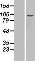 DIAPH3 Human Over-expression Lysate