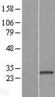 HDHD3 Human Over-expression Lysate