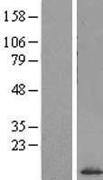 SF3B5 Human Over-expression Lysate