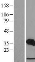 CDCA3 Human Over-expression Lysate