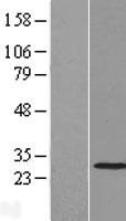 THAP2 Human Over-expression Lysate