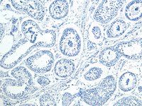 HOXA10 Antibody