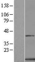 XTP4 (MIEN1) Human Over-expression Lysate