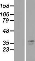 TMPRSS3 Human Over-expression Lysate