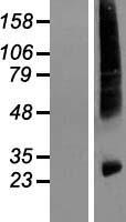 HIATL1 (MFSD14B) Human Over-expression Lysate