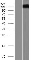 DAB2IP Human Over-expression Lysate
