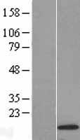 SCOC Human Over-expression Lysate