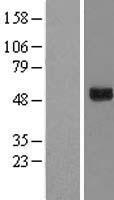 GTPBP3 Human Over-expression Lysate