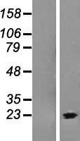 ARRDC1-AS1 Human Over-expression Lysate