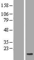 POLR2J2 Human Over-expression Lysate