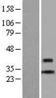 CENPL Human Over-expression Lysate