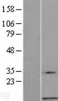 GNG7 Human Over-expression Lysate