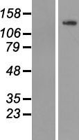 TUBGCP5 Human Over-expression Lysate