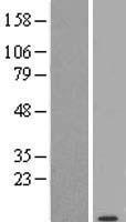CYTOR Human Over-expression Lysate