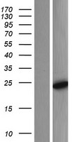 COMMD7 Human Over-expression Lysate