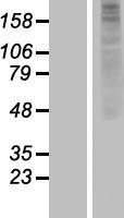 OR1J2 Human Over-expression Lysate