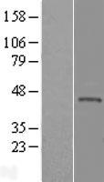 KLHDC3 Human Over-expression Lysate