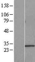 C21orf70 (FAM207A) Human Over-expression Lysate