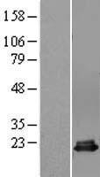 p18 INK4c (CDKN2C) Human Over-expression Lysate