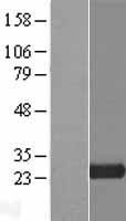 C20orf118 (TLDC2) Human Over-expression Lysate