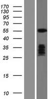 TBX1 Human Over-expression Lysate