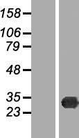 TREX2 Human Over-expression Lysate