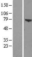 ZSWIM3 Human Over-expression Lysate