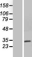 NEURL2 Human Over-expression Lysate