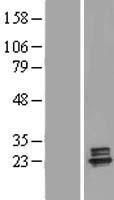 Deoxyguanosine kinase (DGUOK) Human Over-expression Lysate