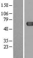 ACOT12 Human Over-expression Lysate
