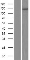 UBE3B Human Over-expression Lysate