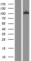UBE3A Human Over-expression Lysate