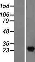 KCNG4 Human Over-expression Lysate