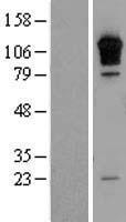 RGS3 Human Over-expression Lysate