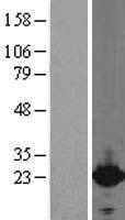Cytoglobin (CYGB) Human Over-expression Lysate