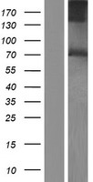 PACE4 (PCSK6) Human Over-expression Lysate
