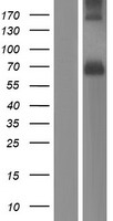 PACE4 (PCSK6) Human Over-expression Lysate