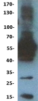 C6orf150 (MB21D1) Human Over-expression Lysate