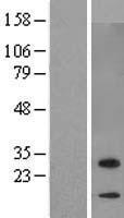 C7ORF29 (ZBED6CL) Human Over-expression Lysate