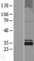 OXNAD1 Human Over-expression Lysate