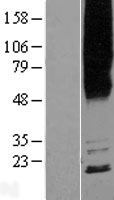 MYADM Human Over-expression Lysate