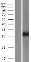 TMEM116 Human Over-expression Lysate