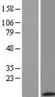 ACYP2 Human Over-expression Lysate