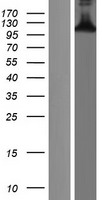 CTIP2 (BCL11B) Human Over-expression Lysate
