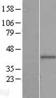 PIH1D2 Human Over-expression Lysate