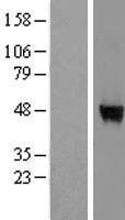WDR85 (DPH7) Human Over-expression Lysate